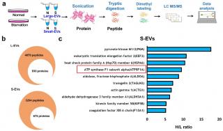 Ectopic ATP synthase stimulates the secretion of extracellular vesicles in  cancer cells